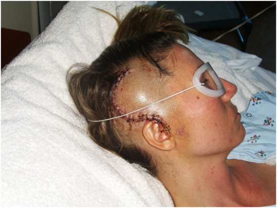 Augmentation de 50% des tumeurs du cerveau chez les enfants au Royaume-Uni en 10 ans + 40% au Danemark, en Finlande - explosion du phénomène en France - 30/05/2012 Augmentation de 50% des tumeurs du cerveau chez les enfants au Royaume-Uni en 10 ans + 40% au Danemark, en Finlande - explosion du phénomène en France - 30/05/2012
