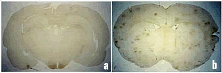 Salford et al. 2003 - 'Dégâts aux cellules nerveuses de cerveaux de mammifères après exposition à des micro-ondes de téléphones mobiles GSM' Salford et al. 2003 - 'Dégâts aux cellules nerveuses de cerveaux de mammifères après exposition à des micro-ondes de téléphones mobiles GSM'